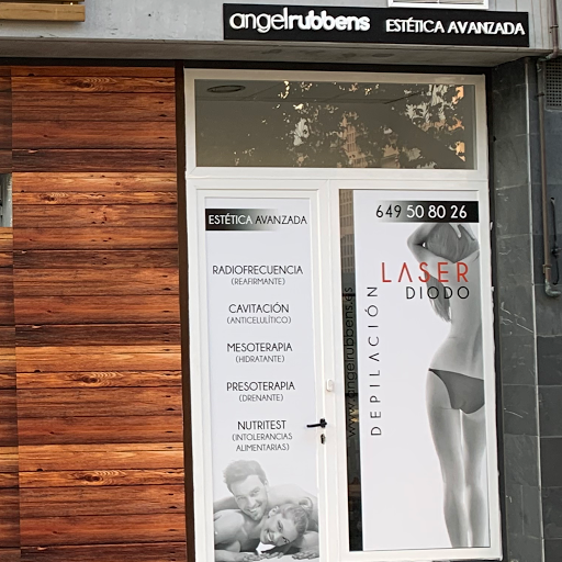 17860 depilacion laser angelrubbens