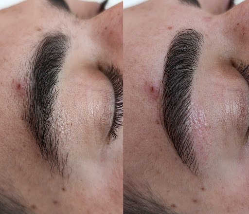 19883 estetica avanzada estefania paris